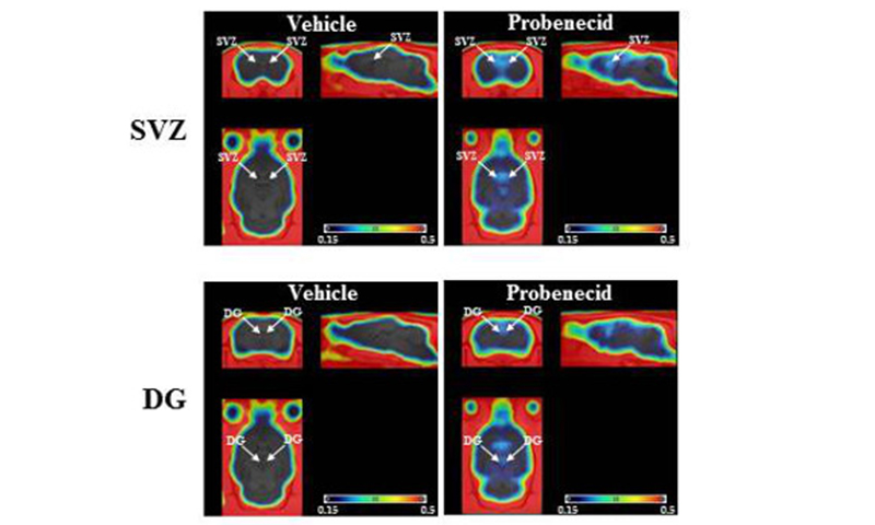 PET images show increased accumulation of the tracer [18F]FLT in rats.