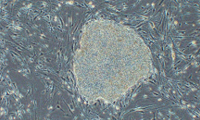 Photo of iPS cell