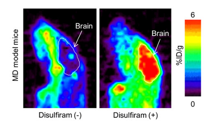 Sagittal section of brain PET image at 4 hrs after (64)CuCl2 injection with disulfiram or D-penicillamine in MD model mice